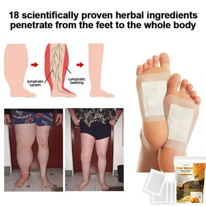 Bee Venom Lymphatic Drainage &amp; Slimming Foot Patches